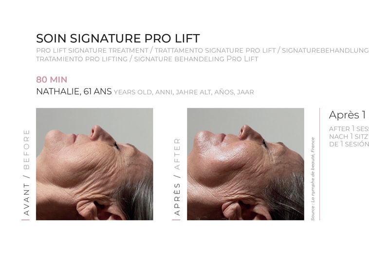 Lorem ipsum set doloris