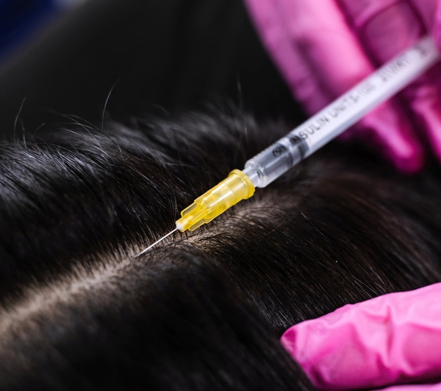 Dr. Cyj – mezoterapia peptydowa: włosy