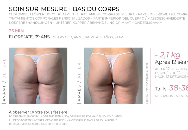 Ipsum