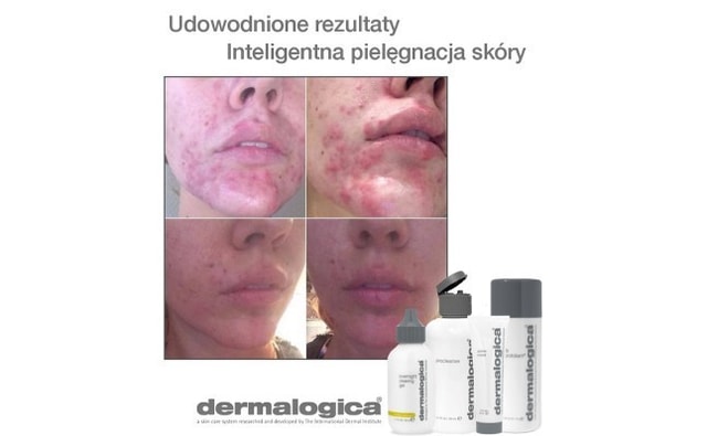 Dermalogica logika zdrowej skory