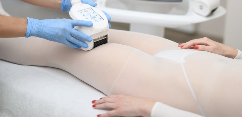 Icoone Laser med 2 – drenaż limfatyczny premium: ciało